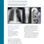 Medical_X-ray_Film_-_General_Purpose _Blue 1 _1