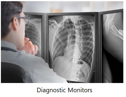 Diagnostic Monitors